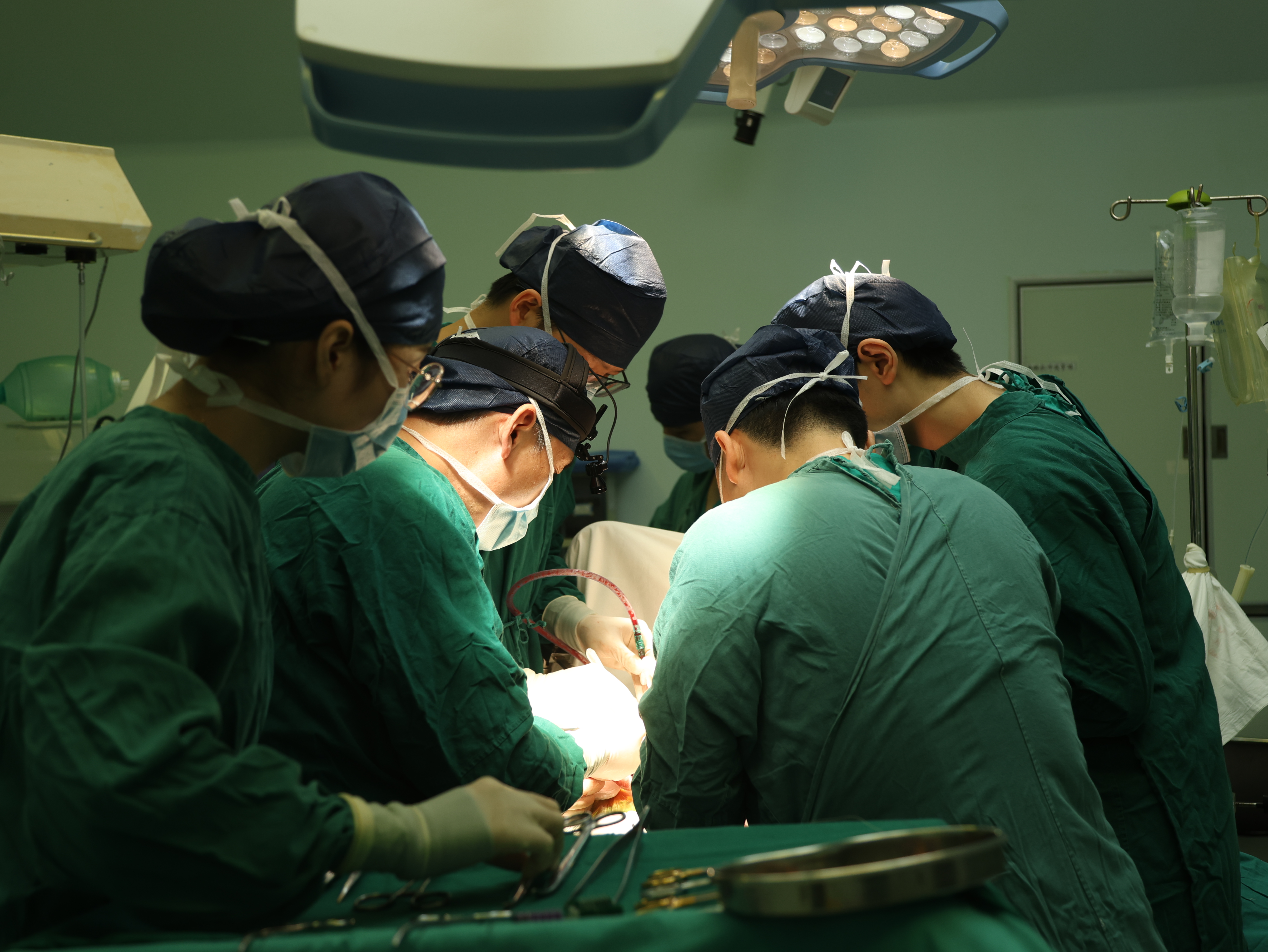 上海首例晚期肝癌患者经过治疗肿瘤明显缩小并成功手术切除