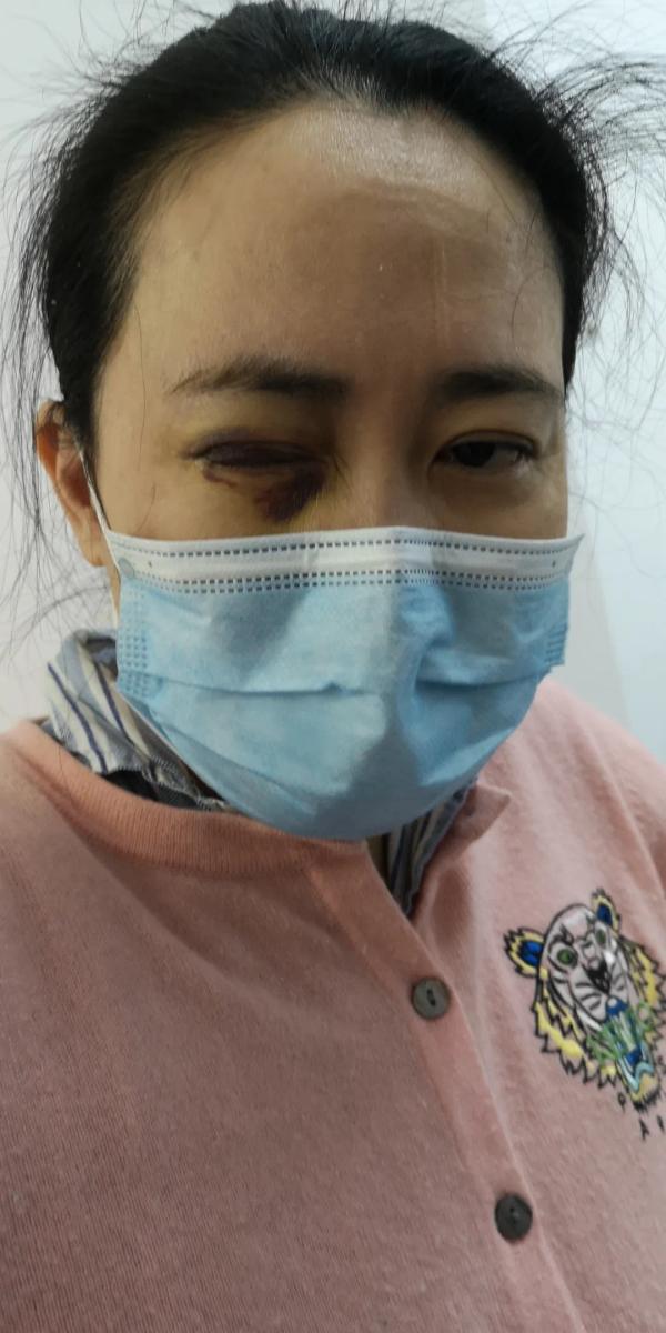爱尔眼科称视网膜脱离与手术无关，艾芬回应：