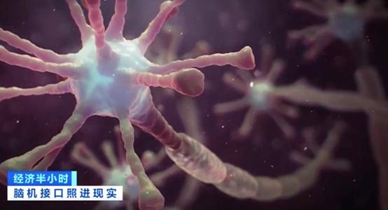 手电极怎么用科幻照进现实！72岁高位截瘫患者竟能用“意念”操纵电脑打麻将_https://www.jmylbn.com_新闻资讯_第5张