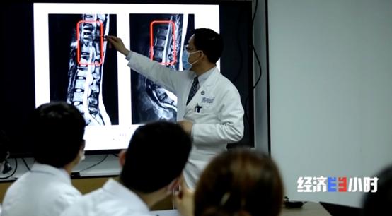 手电极怎么用科幻照进现实！72岁高位截瘫患者竟能用“意念”操纵电脑打麻将_https://www.jmylbn.com_新闻资讯_第14张