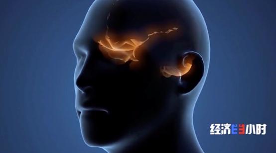 手电极怎么用科幻照进现实！72岁高位截瘫患者竟能用“意念”操纵电脑打麻将_https://www.jmylbn.com_新闻资讯_第6张