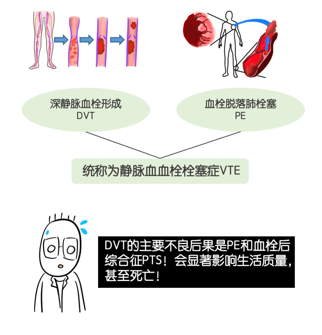 科普静脉血栓栓塞症如何防治