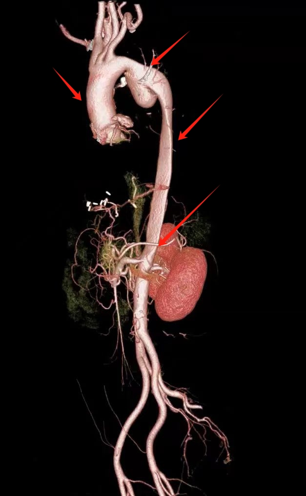 它们被 2.7 万块定日镜环绕