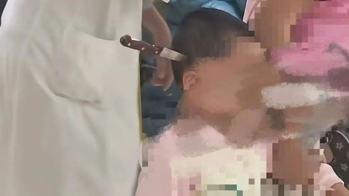 受伤儿童视频 cb20250818093456489056.jpg