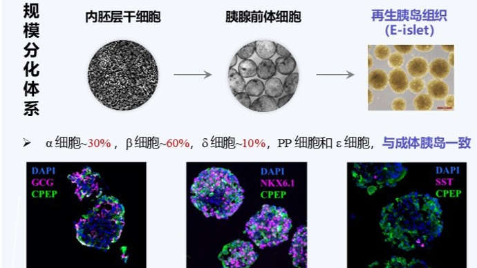 全球首例！我国实现再生胰岛移植，为糖尿病治疗开辟新路径