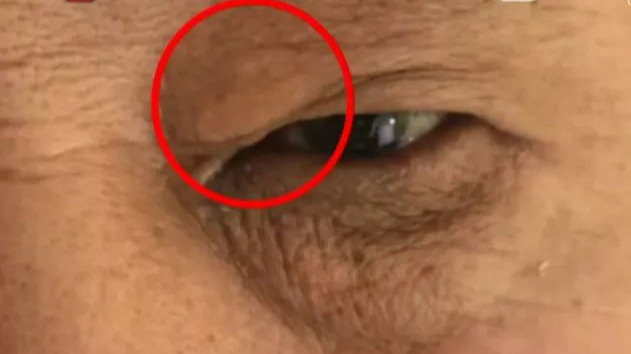 七旬老伯陪老伴住院，医生多看了他一眼竟发现猝死先兆！一查果然凶险……