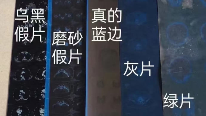 银价上涨催生医院CT胶片回收热？线上有人大量收，开价2元一张