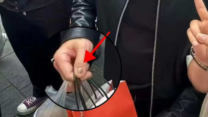 黄仁勋的指甲冲上热搜！高清镜头曝光，网友吵翻！医生：这6种情况都可能