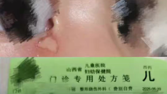 事发5A级景区！男子抽烟烫伤2岁男童眼角，支付600多元医药费后失联