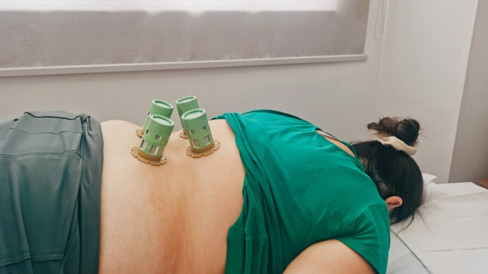 冬病夏治门诊里的外国面孔｜新民特写