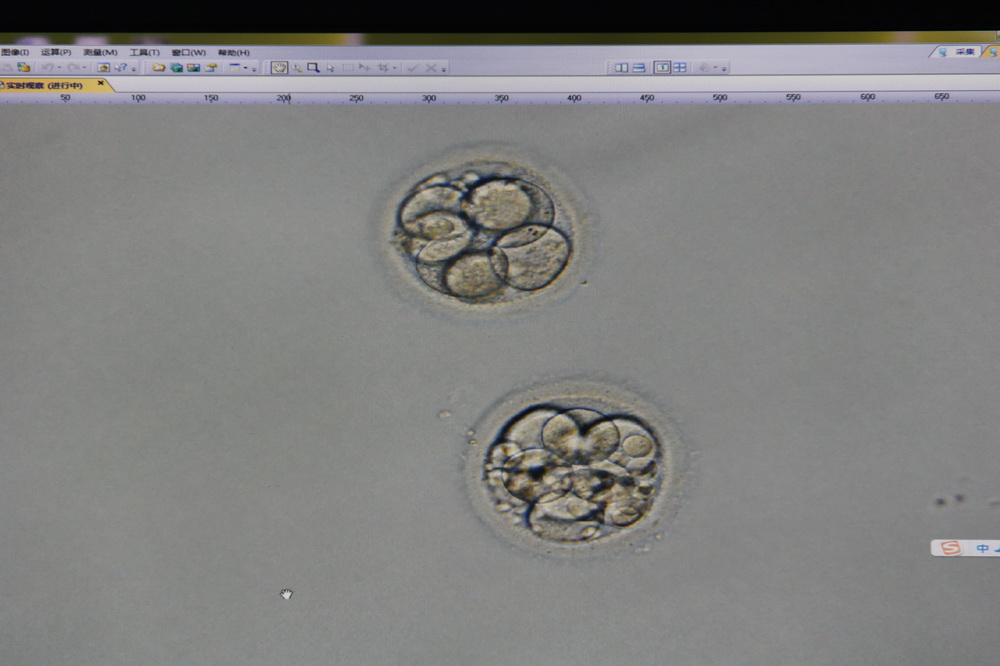 显微镜下的胚胎(受精卵).