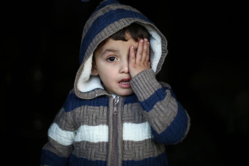 【看世界】"独眼"群像:声援失去左眼的叙利亚战争孤儿